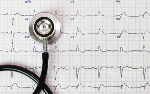 o-que-e-eletrocardiograma-e-como-e-feito