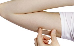 implante-anticoncepcional-implanon