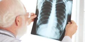 tuberculose-sintomas-diagnostico-e-tratamento.