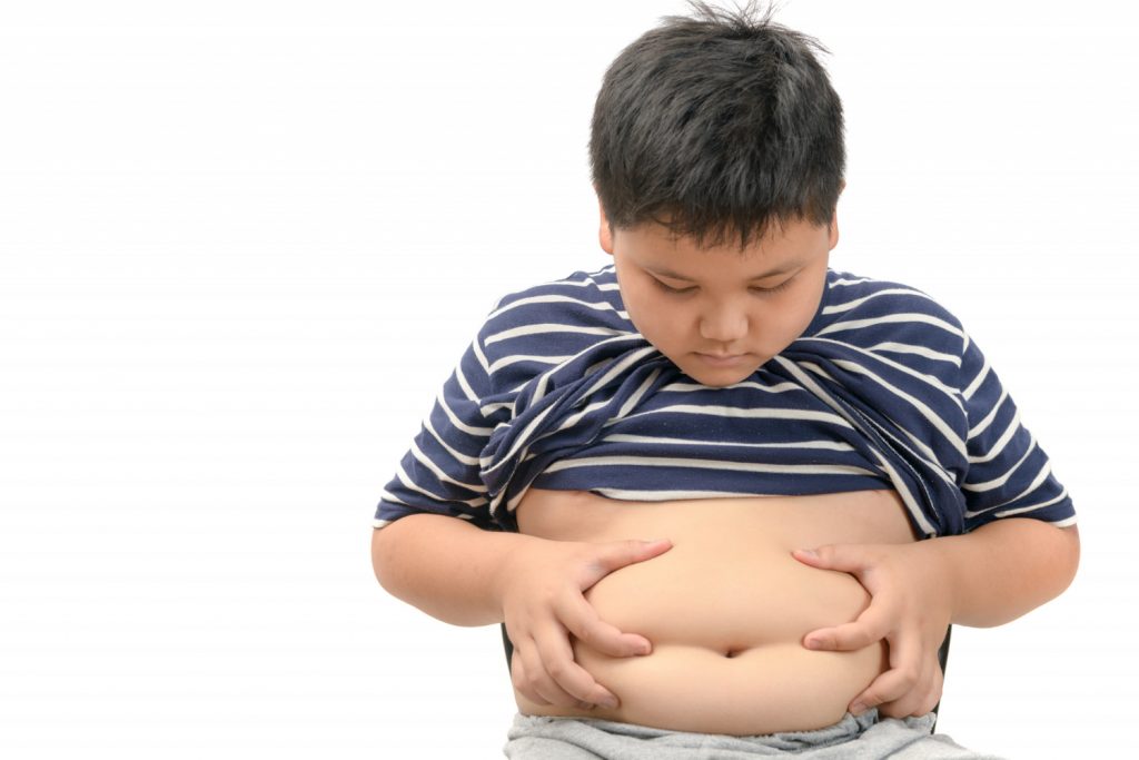 obesidade-infantil