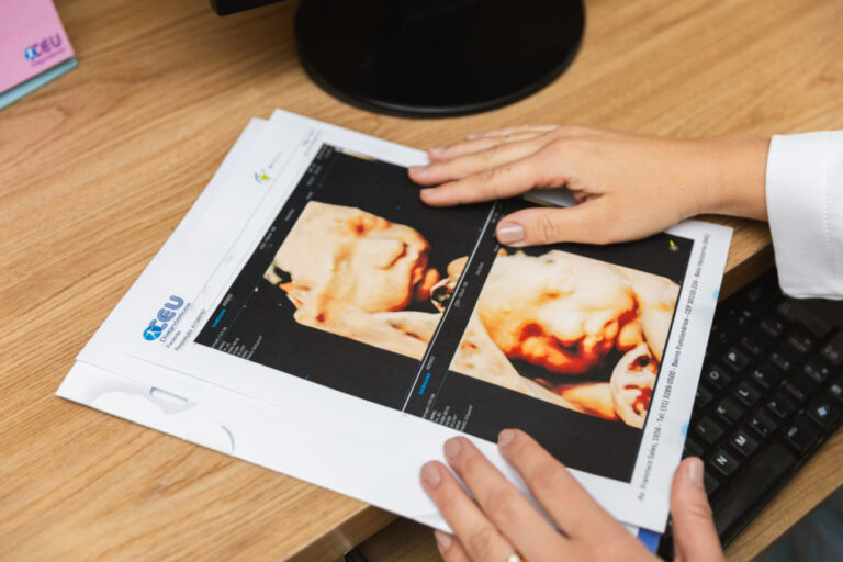 clinicaceu_O que é o ultrassom 3D